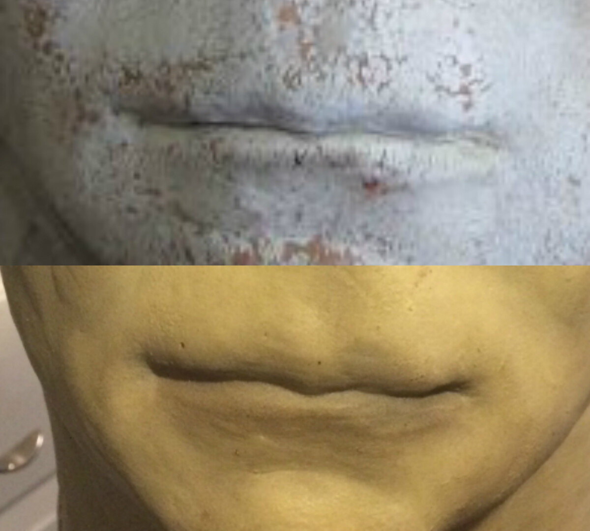 collageh4mouth.jpg